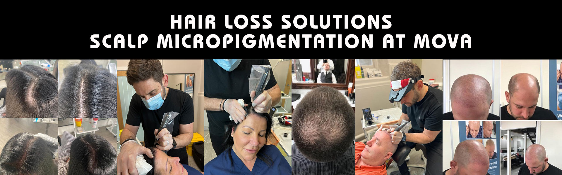 Hair Loss Solutions at Mova hairdressers in Staines upon Thames