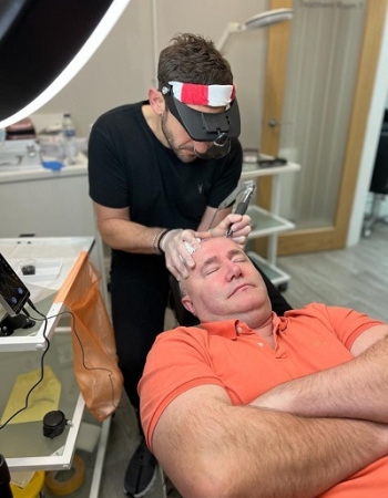 Scalp-pigmentation-for-bald-men-at-Staines-hairdressers